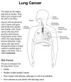 lung cancer factsheet health info translations