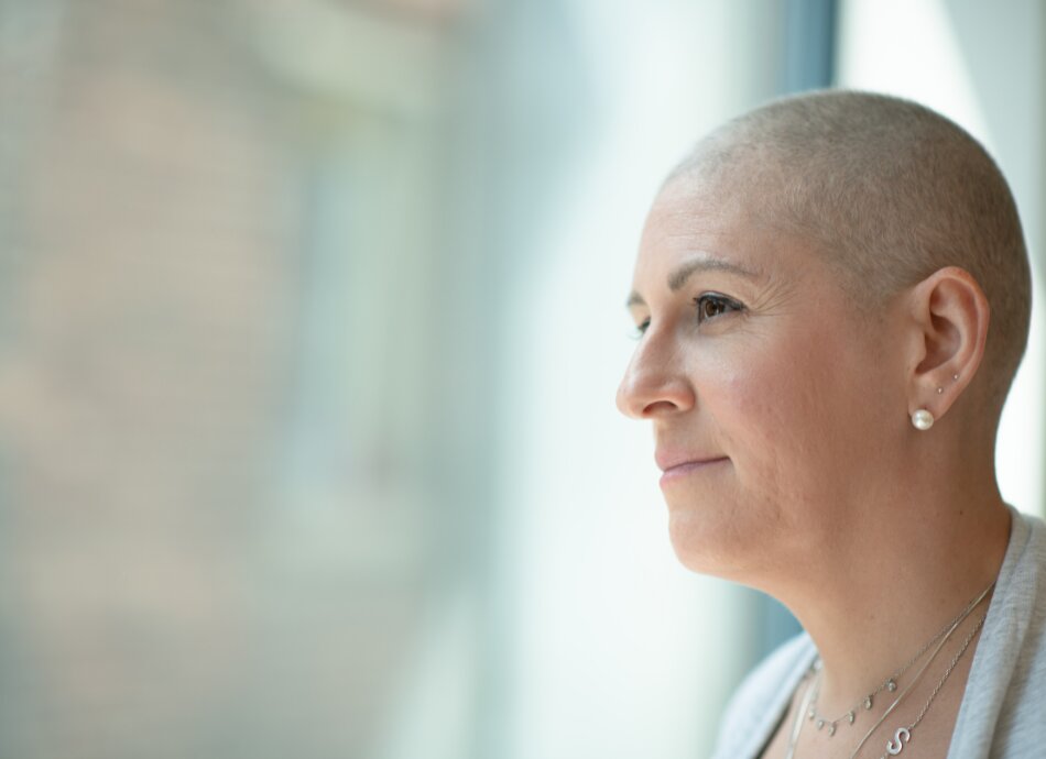Woman with cancer hair regrowth looks out window