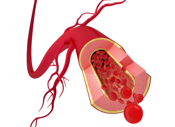 Image of healthy artery and blood flow