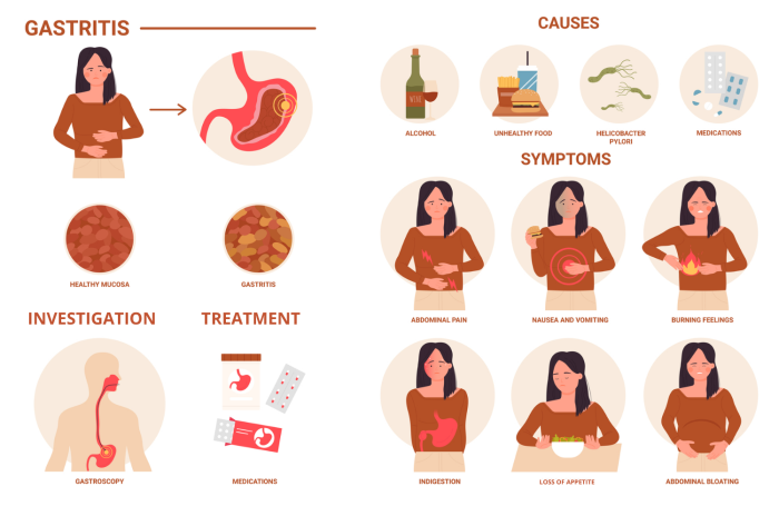 Gastritis causes, symptoms, investigation and treatment