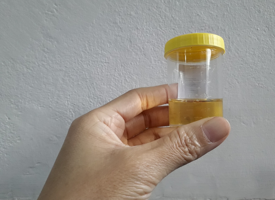Hand holding urine sample in container
