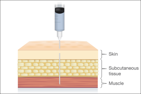 Intramuscular injection