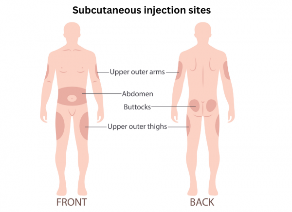 Sites on body where subcutaneous injections can be given