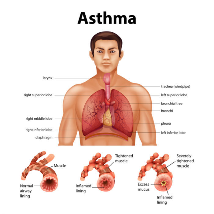 Diagram of labelled respiratory system and normal and asthmatic airways