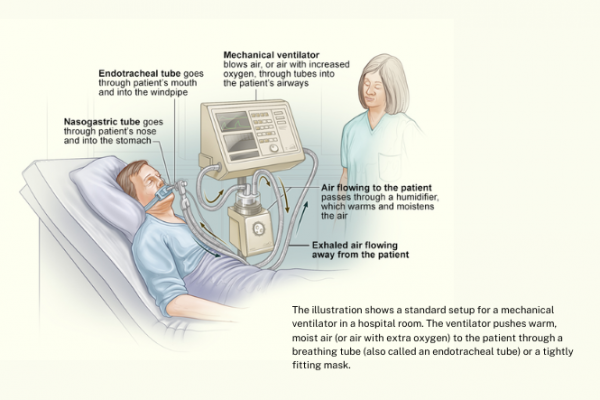 Ventilator machine and description of how it works