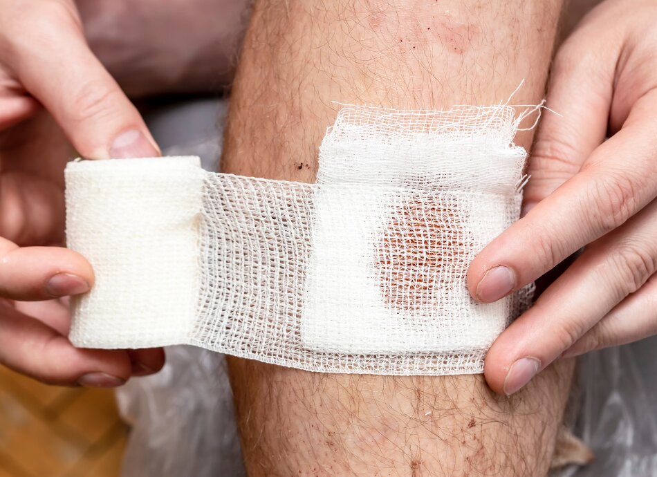 Bandage with bleeding pad being wrapped around leg wound