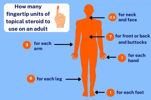Diagram of adult body showing the number of FTUs to use for each body area