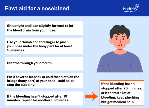 First aid for a nosebleed