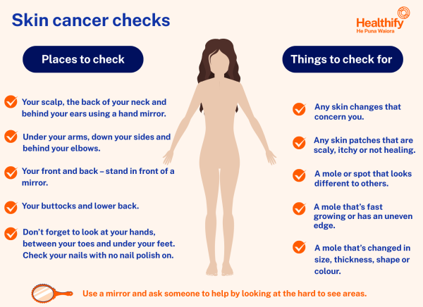 Places to check for skin cancer and what to look out for