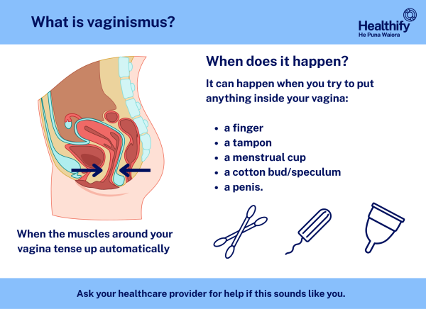 Infographic explaining vaginismus and when it can happen