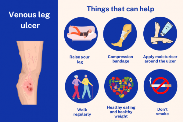 Infographic showing an image of a venous leg ulcer and ways to look after it