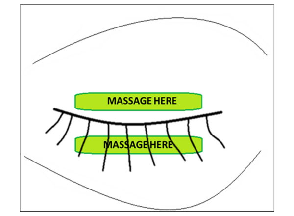 Where to massage eye to unblock tear glands