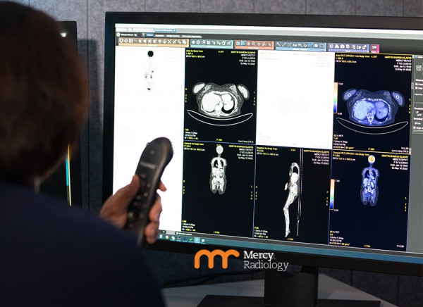 Close up on PET-CT scan images on a screen