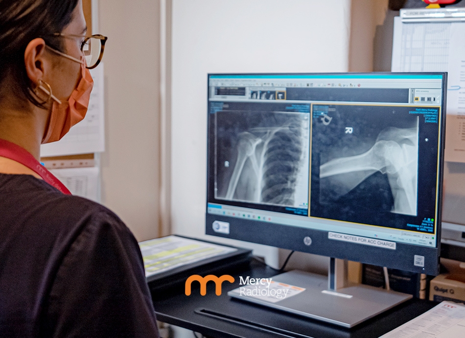 Looking at X-ray Mercy Radiology