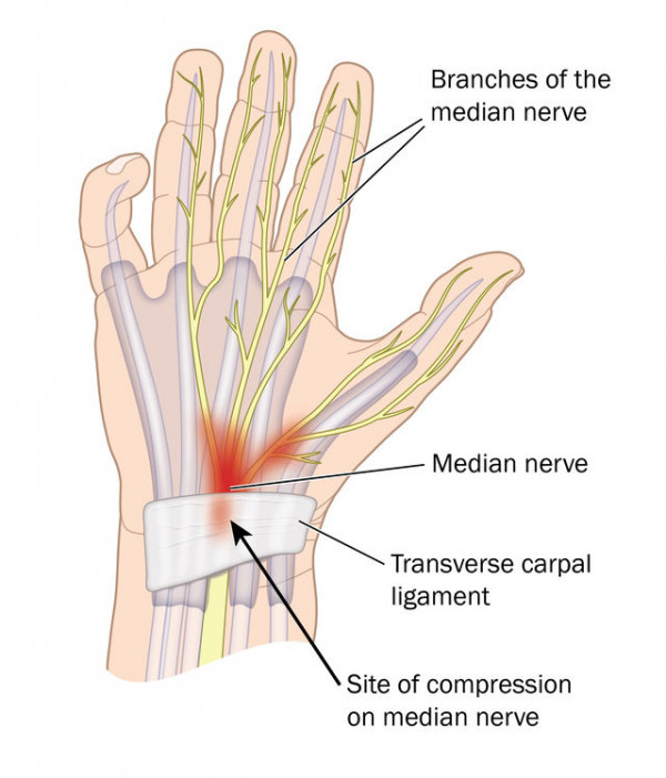 Carpal Tunnel Exercises Print Digital Blue Hand and Wrist