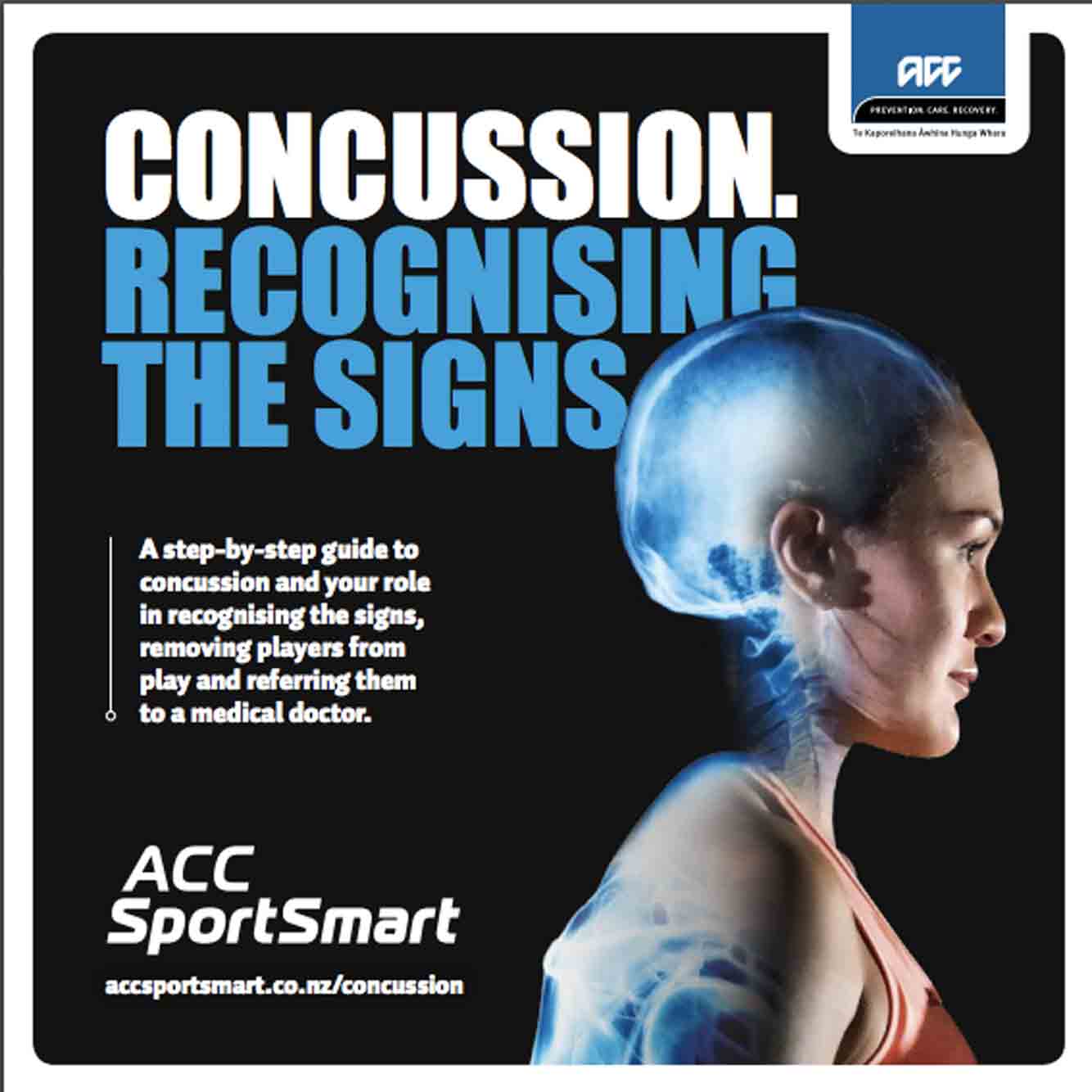 concussion recognising the signs acc sportsmart