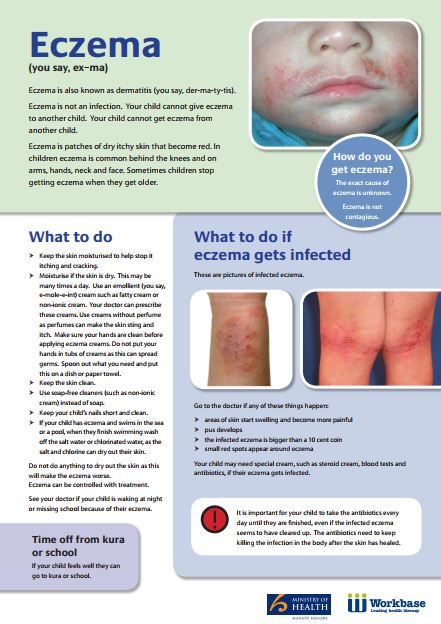 eczema brochure