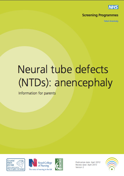 neural tube defects ntds anencephaly