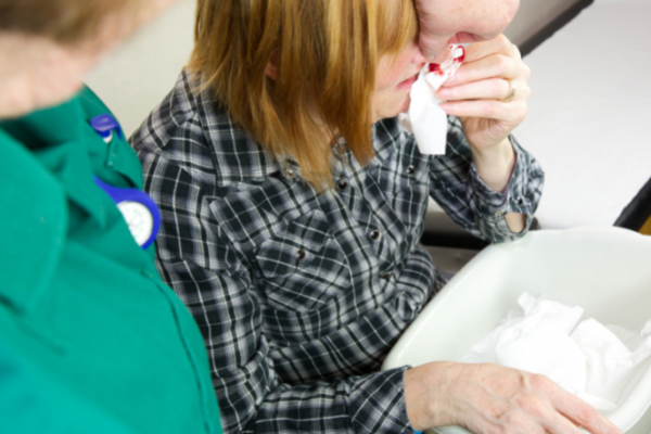 Woman holding tissue to bleeding nose