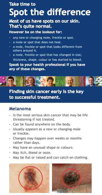 take time to spot the difference cancer society nz