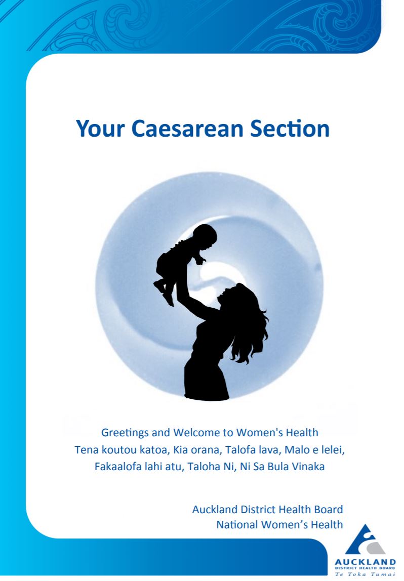 your caesarean section